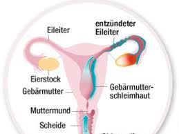 Wenn Es Im Intimbereich Juckt Und Brennt So Wird Man Die Erreger Wieder Los Welt