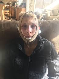 C. Jeff Kesler, MD, Board Certified Plastic Surgeon