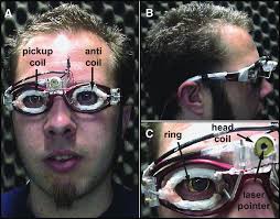 Subject wearing coil assembly and ring. A: frontal view. Note that the...