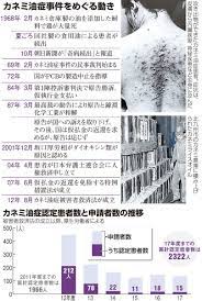 1 definitions matched, 1 related definitions, and 0 example sentences definition of カネミ油症. ä»Šã•ã‚‰èžã'ãªã„ ã‚«ãƒãƒŸæ²¹ç—‡ ã„ã¾ã‚‚ä¸ååˆ†ãªè¢«å®³è€…æ•'æ¸ˆ æœæ—¥æ–°èžãƒ‡ã‚¸ã‚¿ãƒ«