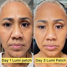 What if I told you I have a product that gives these results with no  chemicals and no ingredients??? Visit my link to my website to order The  Lumi Patch ! Order