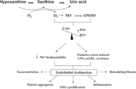 Image result for Hyperuricemia