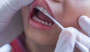 It S Time For The Fluoride Varnish Taste Test Dentistry Co Uk