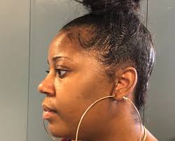 Five people intend to sue over injuries they suffered in melee with police 