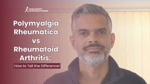 Image result for Polymyalgia Rheumatica