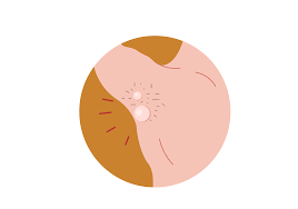 Although the percentage of cases in men is much lower than in women, male breast cancer accounts for a por. 13 Causes Of Armpit Lumps In Men Buoy