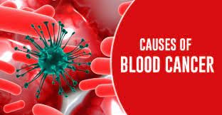 Blood cancer represents a large group of different malignancies. The Causes Of Blood Cancer And Possible Prevention