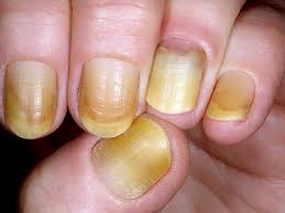 Pastel yellow nails should be a nice unexpected change from the norm. Almond Pastel Yellow Acrylic Nails Nail And Manicure Trends