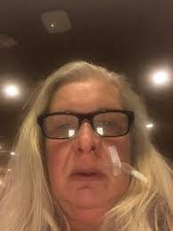 BLOODY NOSES!!!? Anyone deal with these? I'm talking 30 Min long clotting  ones. Not regular ones