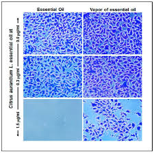 Antibiotics Free Full Text Effect Of Citrus Aurantium L Essential Oil On Streptococcus Mutans Growth Biofilm Formation And Virulent Genes Expression