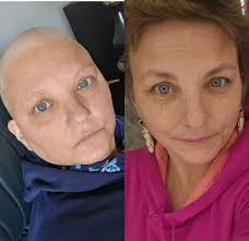 I lost my front legs to cancer, do you still love me? 🥺🥺🥺