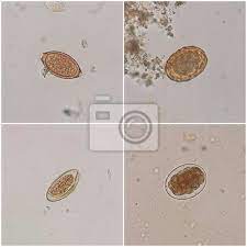 Warum ein wurmbefall über den stuhl trotzdem nur selten diagnostiziert wird, hat. Die Parasiten Im Stuhl Die Obere Linke Ist Trichuris Trichiura Leinwandbilder Bilder Medicals Eizellen Kot Myloview De