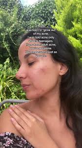 You’re not alone ❤️ #acne #trend #viral #selflove #foryou