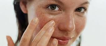 Cilt Lekelerine Dogal Cozum Skin Hyperpigmentation Sunspots Sun Spots Removal