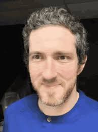 Glaucomflecken Jonathan GIF