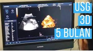 Meski demikian, panduan di bawah ini bisa menjadi parameter pertumbuhan janin dari minggu ke minggu. Ibu Hamil Usg 5 Bulan Anak Pertama Youtube