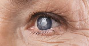 عملية سحب الماء من العين دليلك الشامل ويب طب