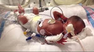The babies have spent the time since then in the neonatal intensive care unit at the hospital. Shocking Surprise For Woman Expecting Identical Triplets Abc News