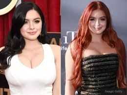Learn more about what the whipple procedure does and what to expect if you or someone you love is due to have this lymph. 20 Most Influencing Best Plastic Surgery Before And After