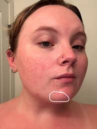 Hey ladies! Does anyone have any recommendations for muscle recovery?  Getting back into the gym and I'm dying over here 😬