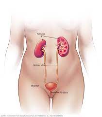 Kidney Infection - Symptoms And Causes - Mayo Clinic