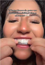Karla Burton Teeth Whitening