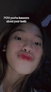 Overcoming Teeth Insecurities: A Personal Journey