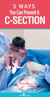 Pin On Pregnancy Care