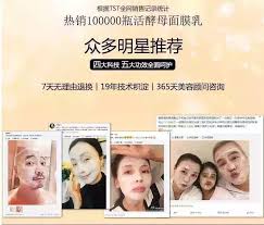 每个女人都值得拥有一瓶活酵母 活酵母5 重直击皮肤问题 美白 保湿 抗衰 修复 祛痘 国家专利 安全认证 拒绝伤害肌肤的有害成分