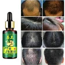 7days jonk oil is 100% pure jonk oil ( leech oil) which is highly effective in hair regrowth and also prevents hair related disease. 7 Days Hair Growth Ginger Germinal Oil Hair Tonic Growth 30ml Green Box Shopee Malaysia