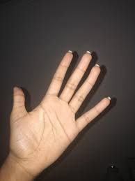 Maybe you would like to learn more about one of these? Help How Do I Get Rid Of These Wrinkles On My Hands Scacirclejerk