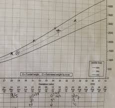 Slight Drop On Growth Chart Babycenter