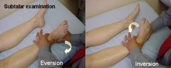 Sinus Tarsi Syndrome Physiopedia