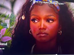 Jeremiah's Eye Injury