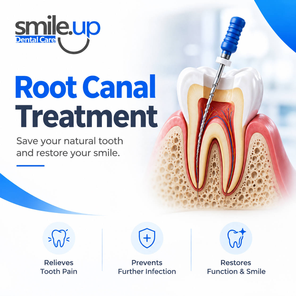 Root Canal Treatment (RCT) product image