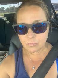 Amputees' experiences with wearing shorts and social interactions