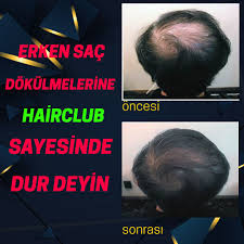 Dogal Sac Losyonu Instagram Photo And Video Instagram Photo