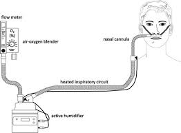 Oxygen cannulas or nasal cannulas are used to supply supplementary oxygen to the patient. Use Of High Flow Nasal Cannula Oxygenation In Icu Adults A Narrative Review Springerlink