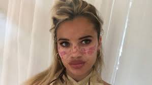 1 background 1.1 the house 1.1.1 house photos 2 twists 3 housemates 4 task history 5 competition history 6 voting history 7 game history 7.1 week 1 7.1.1 round 1 7.1.2 round 2 7.1.3 round 3 7.2. Big Brother Star Tilly Whitfeld Zeigt Bleibende Narben Nach Einem Verpfuschten Tiktok Schonheitsverfahren Nach Welt