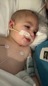 Keelan is doing a lot better, they was able to clear out, and now let it  drain opened to let any remaining exit his head. The Infection hadn't made  its way in
