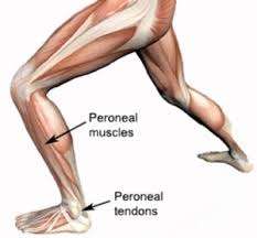 Want to learn more about it? Peroneal Tendonitis Peroneal Tendinopathy Peroneal Tendinosis