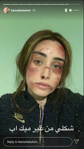 ونشرت «هنا» صورة البوستر عبر «إنستجرام»:«مبروك حبيبي فخورة بيك. Ø¯Ù†ÙŠØ§ ÙŠØ§ Ø¯Ù†ÙŠØ§ Ù‡Ù†Ø§ Ø§Ù„Ø²Ø§Ù‡Ø¯ ØªÙ†Ø´Ø± ØµÙˆØ±Ø© ØµØ§Ø¯Ù…Ø© Ù„Ù‡Ø§ ÙˆØªØ¹Ù„Ù‚ Ø¹Ù„ÙŠÙ‡Ø§ ØªØ¹Ù„ÙŠÙ‚ Ø³Ø§Ø®Ø± ØµÙˆØ±