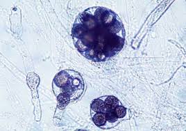 Image result for peronospora grapevine