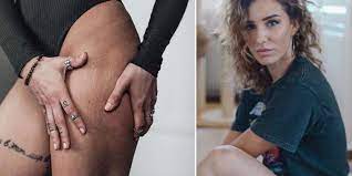 Doch der weg dahin war kein. Anja Zeidler Zeigt Spuren Von Essstorung Und Bodybuilding