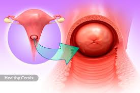 In its early stages, cervical cancer typically does not cause symptoms. A Guide To Cervical Cancer Symptoms Causes Prevention And Treatments