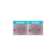 Rp Visage Epil Xpress Hair Reduction Lotion For The Face