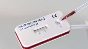 It was first identified in december 2019 in wuhan,. Skepsis Gegenuber Schnelltest Auf Coronavirus Antikorper Rbb24