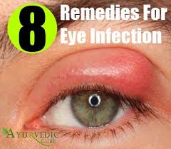 8 Best Herbal Remedies For Eye Infection Treating A Stye Stye Treatment Natural Home Remedies