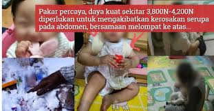 Tubuh si kecil ini sekali lagi didera bapanya apabila ibu meminta bapa kejam itu menjaga bayi berkenaan. Usus Pecah Dan Badan Penuh Lebam Kisah Menyayat Hati Bayi 16 Bulan Jeong In Maut Didakwa Didera Ibu Bapa Angkat