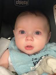 Pray for Donnie Gates as he has the vertigo.